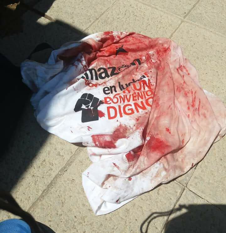 Injured Amazon worker's bloodied shirt.